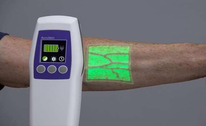 Vein Finder Is an Advanced Medical Device Which Is Used to Search out Vein Networks beneath the Skin Layers