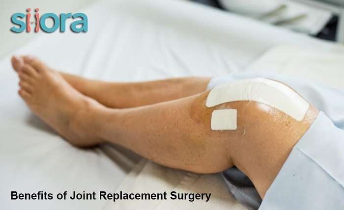 Benefits of Joint Replacement Surgery
