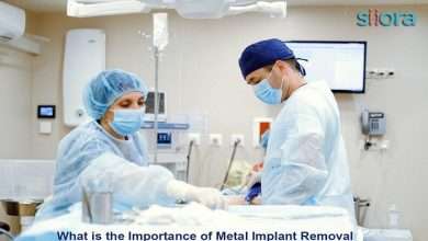 What is the Importance of Metal Implant Removal