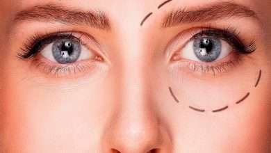 Where can I get Ptosis Surgery in Singapore