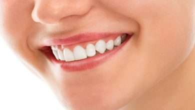 Do Whitening Strips Cause Sensitivity in Teeth